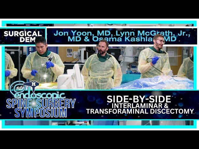 Side by Side : Interlaminar & Transforaminal Discectomy - Jon JW Yoon, MD & Lynn McGrath, MD