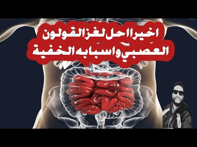 حل لغز القولون العصبي وطريقة علاج القولون مع شرح  واعراض القولون  المختلفة التي لايوجد لها تفسير؟