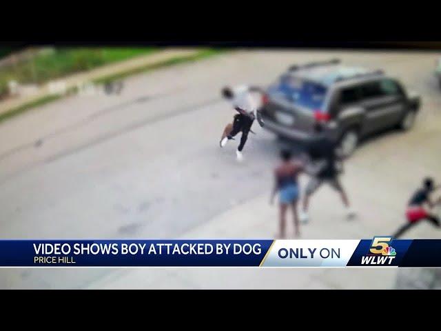 Dog attacks child, man who intervened in Price Hill