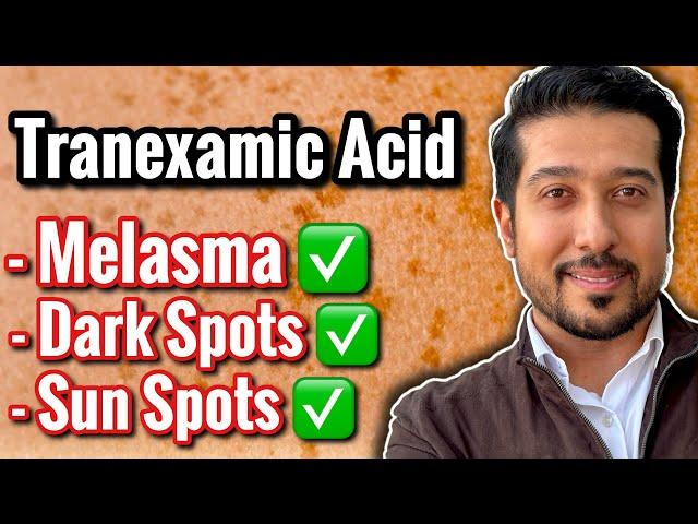 3 BEST Tranexamic Acids for Melasma and Discoloration (not sponsored)