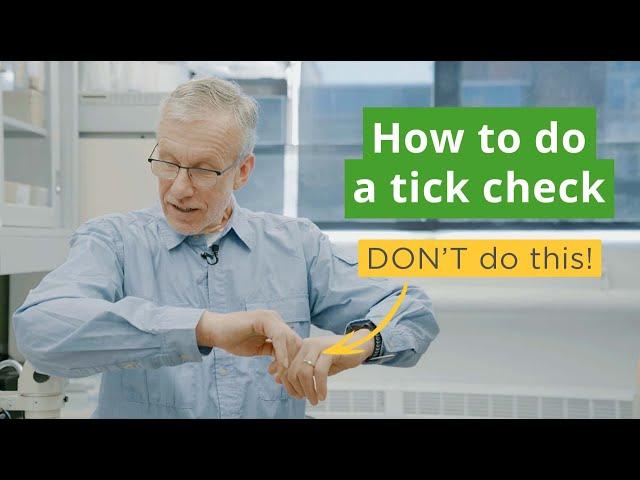 How to Do a Tick Check | Tips for You and Your Pets