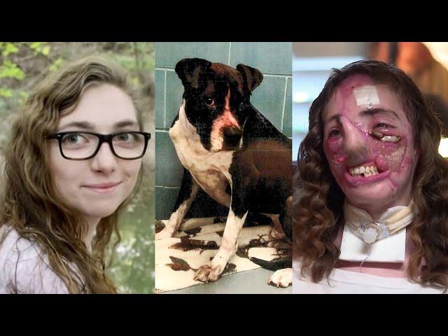 Dog-sitter recovering after a horrific Pit Bull attack