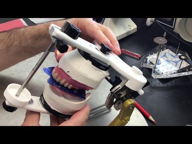 Setting Denture Teeth Using The OMP