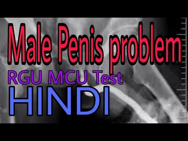 X Ray RGU and MCU Test Hindi | by  Radiographer guruji |