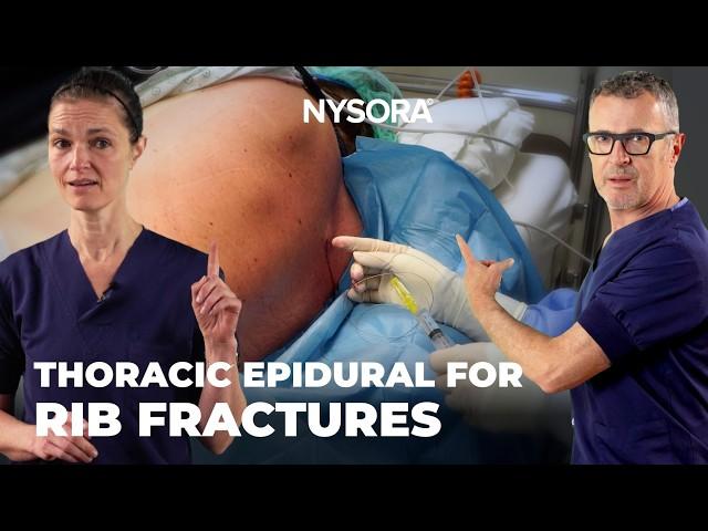 Thoracic Epidural Analgesia: Technique