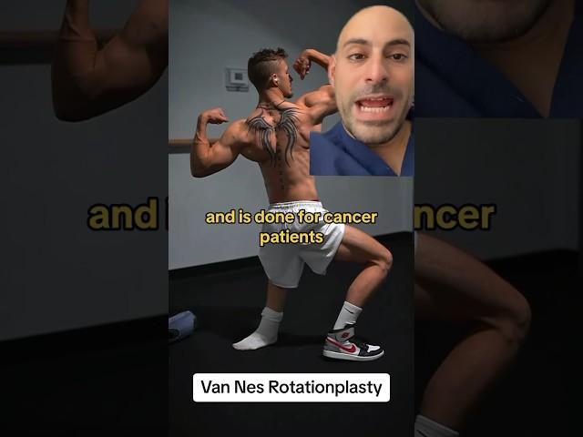 Ankle Fused to Knee after Cancer! #shorts