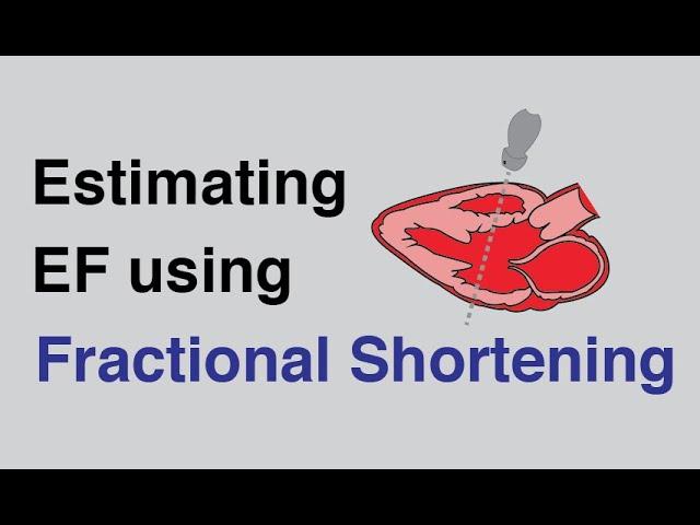 Estimating Ejection Fraction using Fractional Shortening with Cardiac Ultrasound/Echocardiography