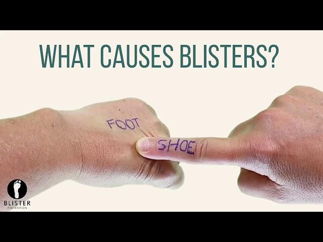 What Causes Blisters On Feet?