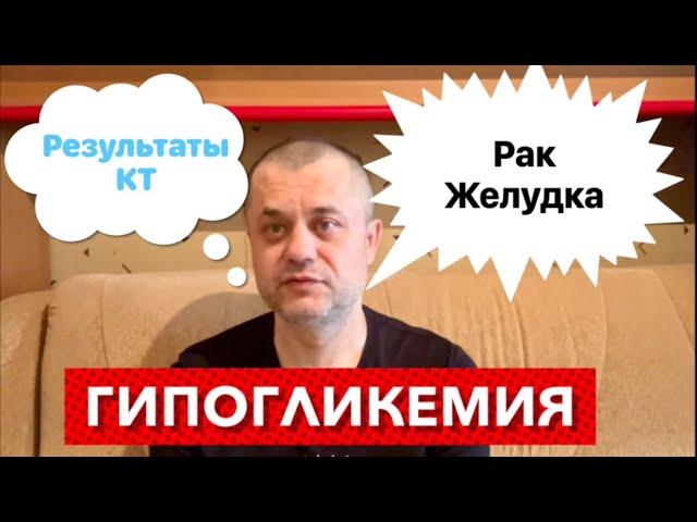 Рак Желудка - Результаты КТ. Галлюцинации и приступ гипогликемии. Было очень плохо и страшно.