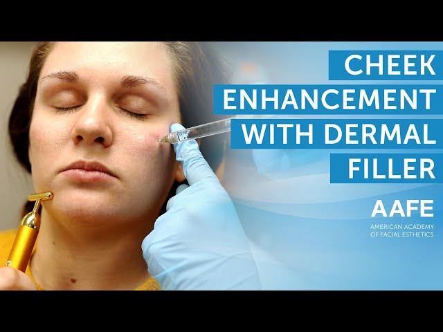 Cheek Enhancement with Dermal Filler | AAFE