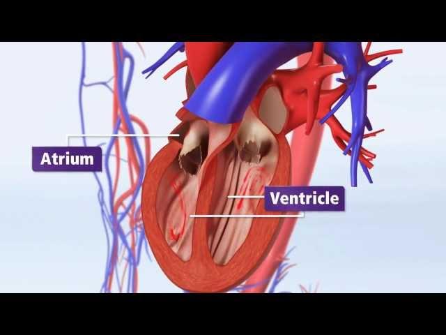Atrial Fibrillation Animation Explained: AFib & Risk of Stroke