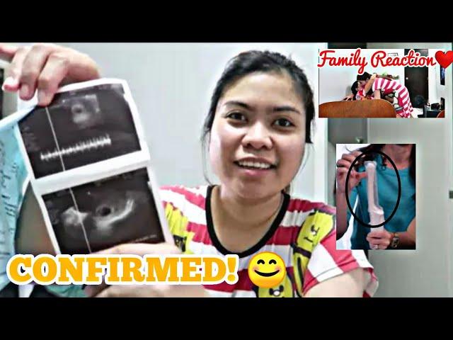 NAG PA ULTRASOUND NA AKO|FIRST TRIMESTER