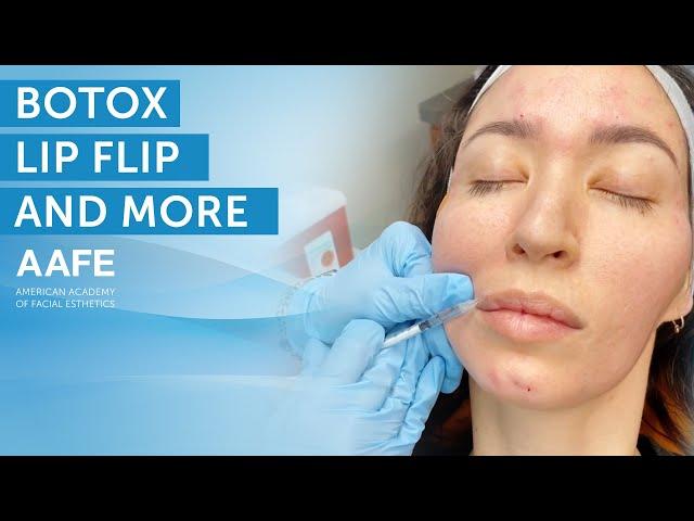 Botox Lip Flip Treatment + More | AAFE