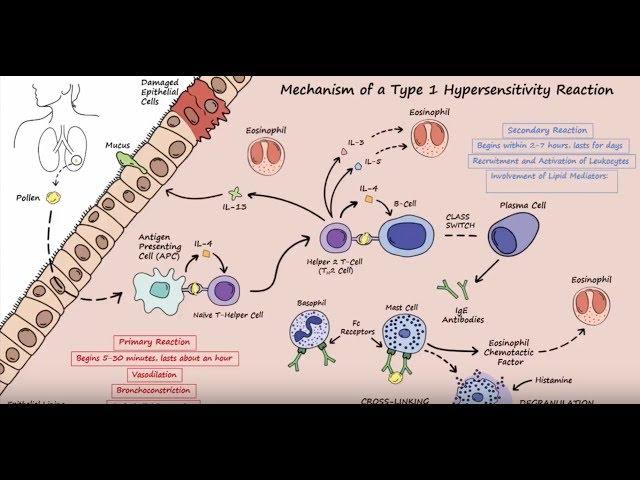 Type I Hypersensitivity - Mechanism (Described Concisely)