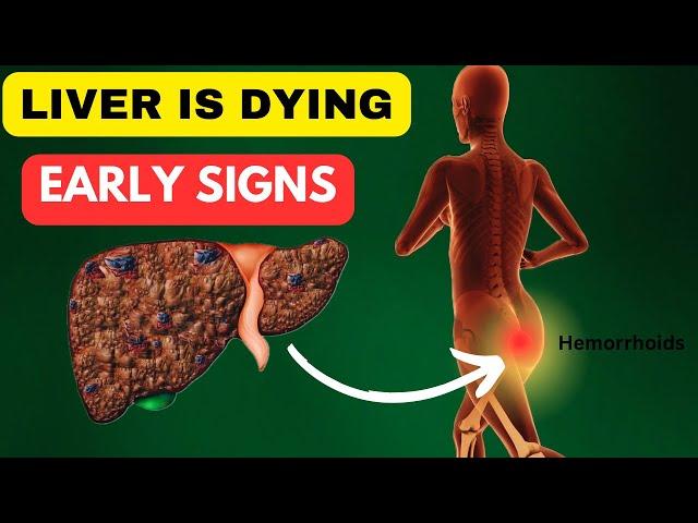 LIVER IS DYING ! 14 weird signs of Liver damage | Tweetflix