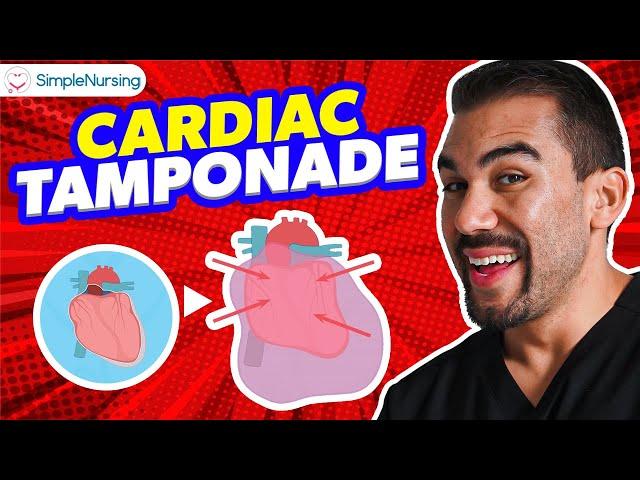 Cardiac Tamponade NCLEX Tips for Nursing Students