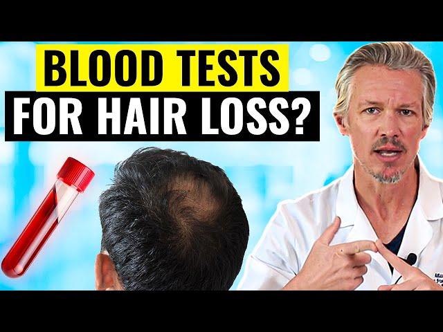 Do YOU need blood tests for your hair loss?