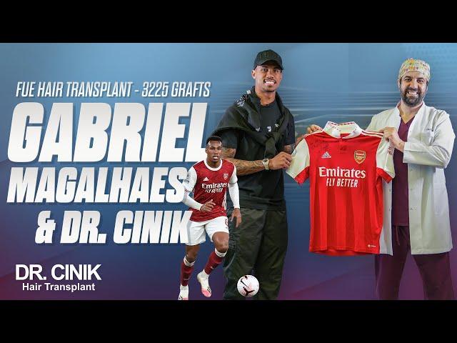 GABRIEL MAGALHAES HAIR TRANSPLANT JOURNEY   Dr.Cinik Hair Hospital