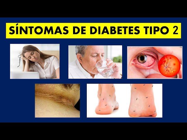  SÍNTOMAS de la DIABETES TIPO 2 que NO DEBES IGNORAR | TODO lo que NECESITAS SABER