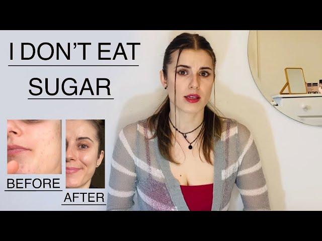 HOW DID I GET RID OF MY ACNE & IMPROVED MY SKIN CONDITION HEALTHY EATING  PART 1