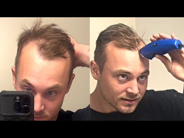 SHAVING OFF MY BALDING/RECEDING HAIR