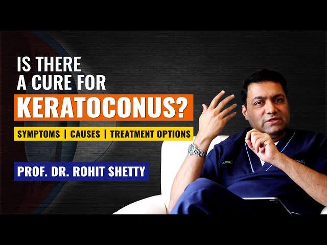 Is there a cure for KERATOCONUS? | Keratoconus Treatment | Symptoms | Causes | Prof. Rohit Shetty