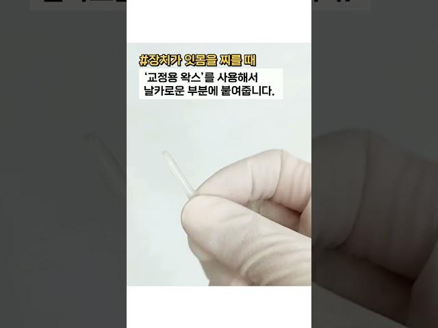 치아교정 중 응급처치 방법! 교정 중 아플 때 대처법