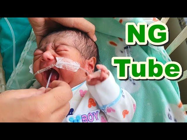 Nasogastric (NG) Tube Insertion in Neonate/Newborn | Orogastric (OG) Tube/Feeding Tube | Paediatric