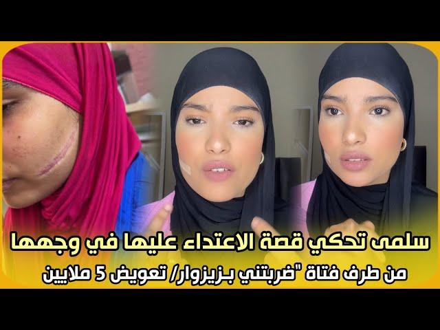 بتفاصيل صادمة..سلمى تحكي قصة الاعتداء عليها في وجهها من طرف فتاة بـزيزوار/تعويض 5 ملايين/حكم بشهراين