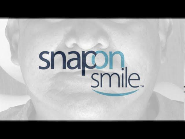 Snap On Smile - La prótesis numero uno del mercado