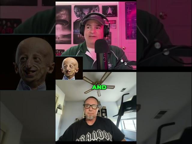 Understanding Hutchinson-Gilford Progeria Syndrome: A Rare Condition
