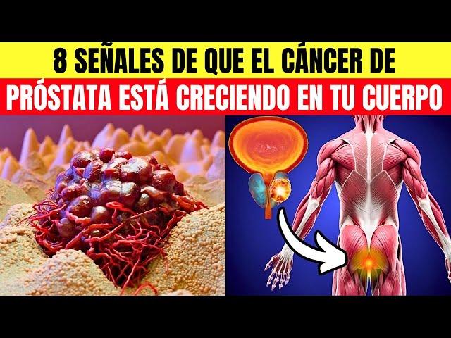 Cáncer de próstata: 8 síntomas tempranos que nunca debes ignorer