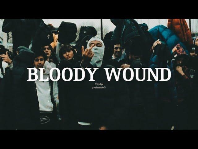 *FREE* Uk Drill type beat 2023 - '' Bloody Wound ''