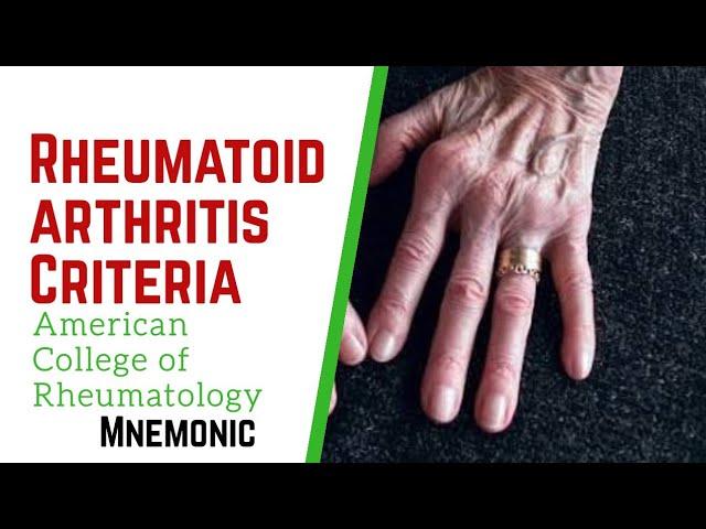 Rheumatoid Arthritis criteria by American College of Rheumatology. Mnemonic