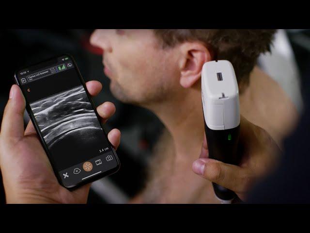 Clarius HD - The Next Generation of Wireless Handheld Ultrasound