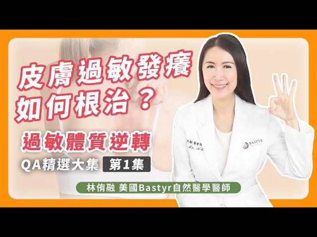 皮膚過敏發癢如何根治？過敏體質逆轉QA 精選大集 第1集 | Dr. Lin 林侑融 美國自然醫學醫師 Ep53