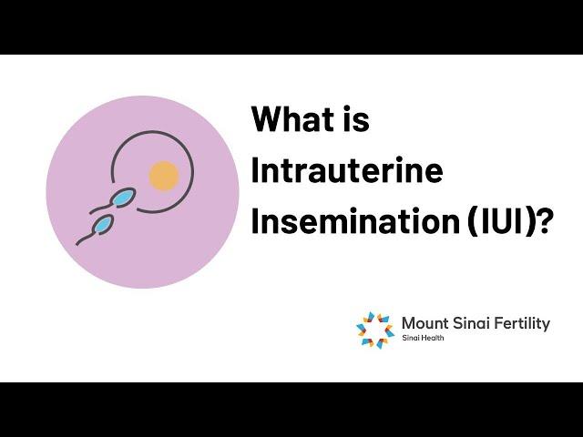 Intrauterine Insemination