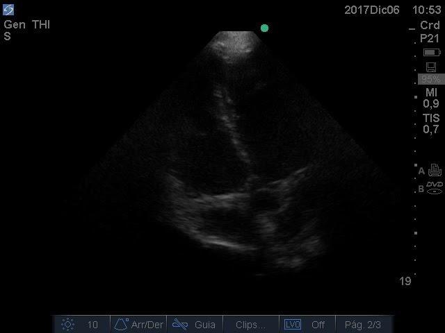 Apical 4c nº4