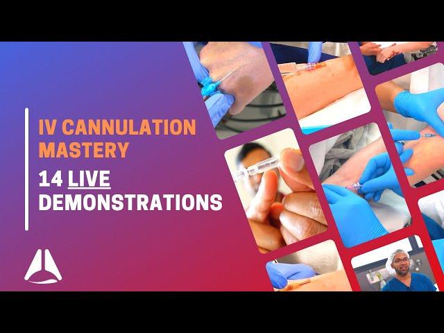 Intravenous (IV) cannulation compilation with demonstration of 14 procedures