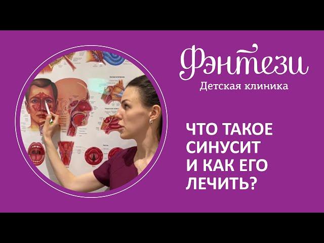  Что такое синусит и как его лечить?