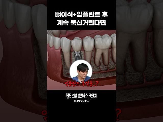 임플란트 뼈이식 시술 후 통증이 계속된다면?