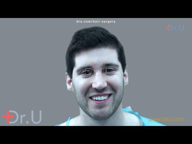 Hair Restoration Real Patient Testimonials