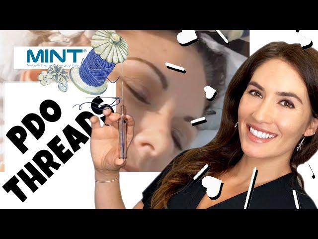 PDO Thread Face Lift | Instant NONSURGICAL Face Lift | Perich Aesthetics Tampa New Port Richey Fl