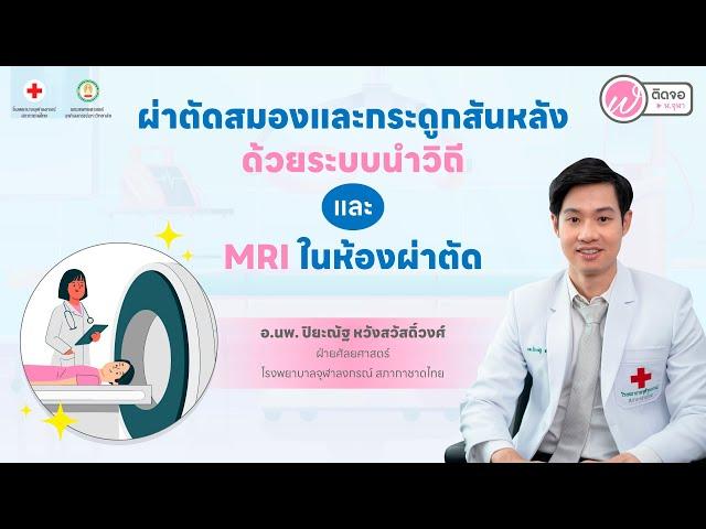 ฟังความข้างหมอ I ผ่าตัดสมองและกระดูกสันหลังด้วยระบบนำวิถี และ MRI ในห้องผ่าตัด