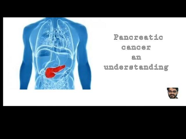 #cancer #pancreaticcancer #understanding of pancreatic cancer