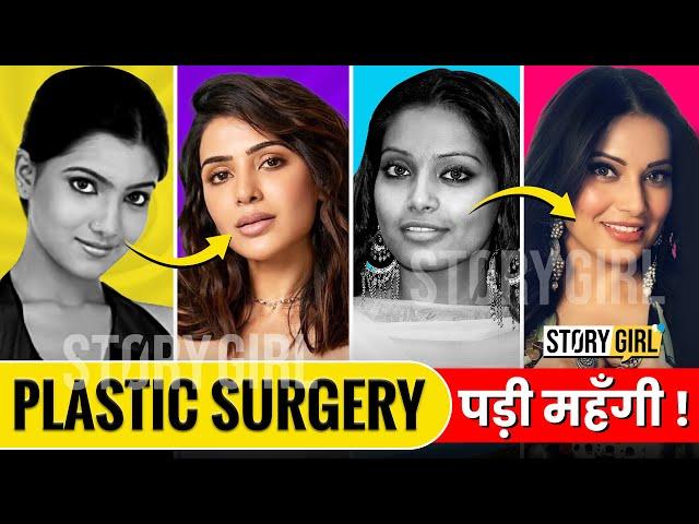 13 Bollywood Actresses With Plastic Surgery | Bollywood Plastic Surgery Before and After