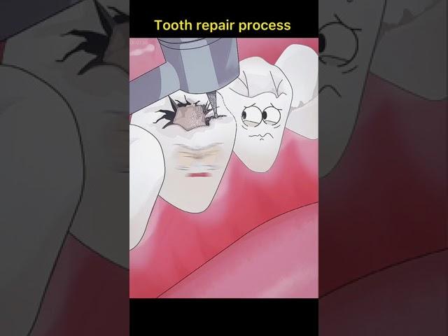 tooth repair process