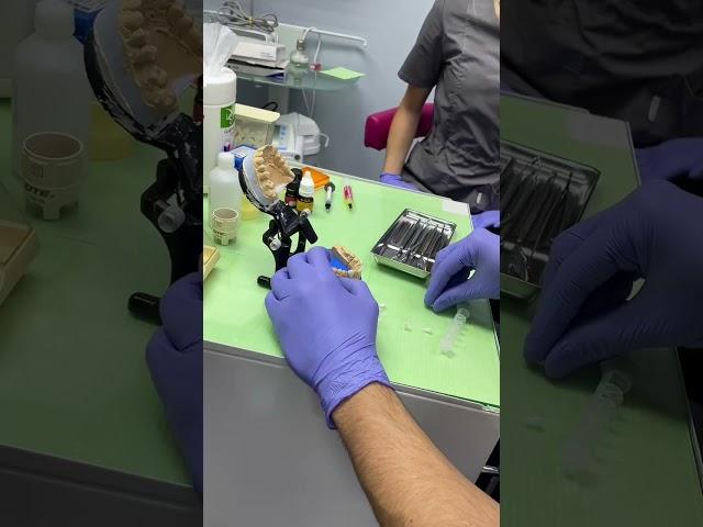 Хотите устранить изъяны в зоне улыбки ? Виниры - лучшее решение! Врач: Луговкин Сергей Александрович