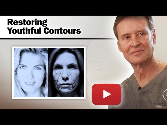 Female Facelift - Restoring Youthful Contours Through Surgical Techniques - Dr. O'Daniel