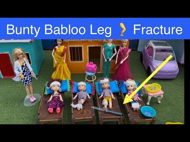 Barbie doll videos Tamil - Episode 8 | Bunty Babloo Leg  Fracture #barbie #chintu #bunty